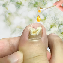 (Watson’s is very popular this year) Just drop it and it won’t repair or repair your hands and toes with potassium which is suitable for both men and women.