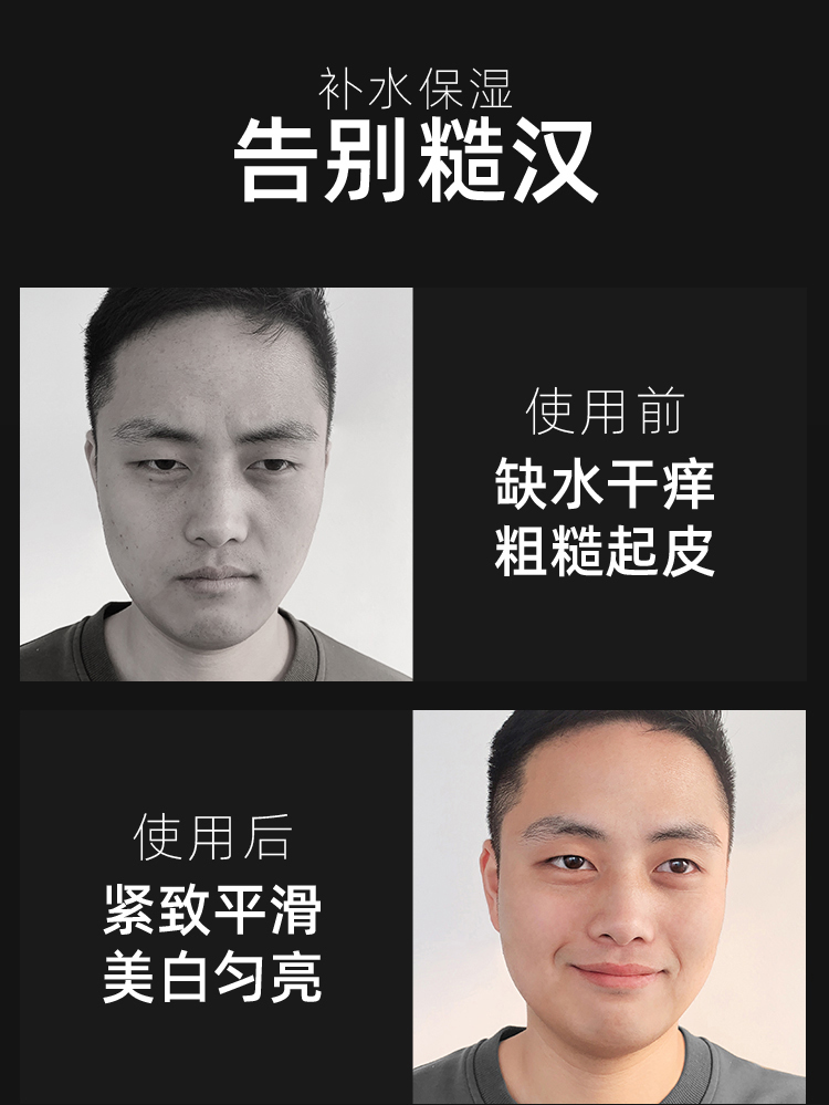 韩国进口 AHC 男士水乳套装 三件套 图6
