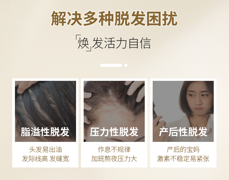 真有效的国药OTC 蔓迪 米诺地尔酊 女性防脱生发喷剂 30ml 图3