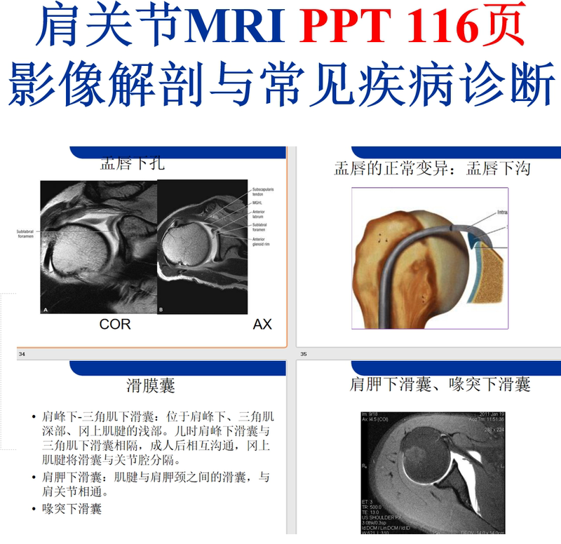 Mri Imaging Anatomy of the Shoulder Joint and Diagnosis of Common Diseases Ppt Slide Course Materials