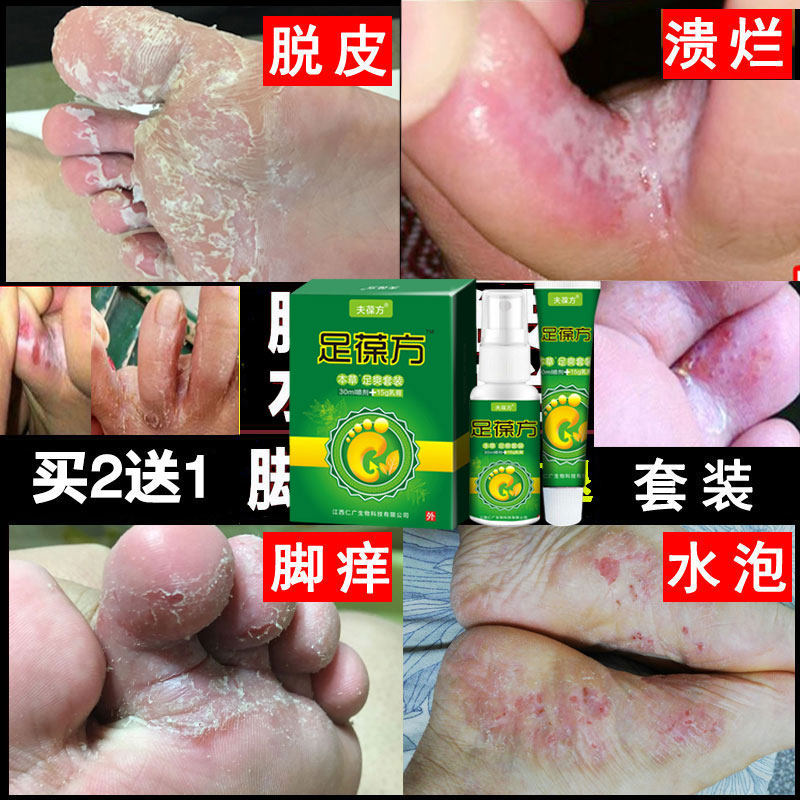 Foot-in-foot air spray anti-itch cream feet Blissful Feet Girl Germicidal Deodorized Feet Up to Soak Up-Taobao