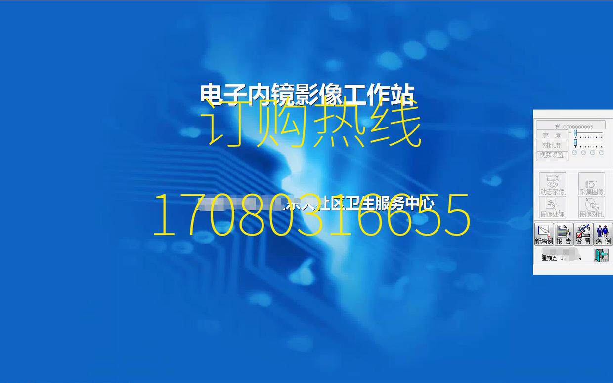 Endoscopy endoscopy every day Xiangshang WIN10 version gastroenteroscopy software Suotu gastroscope workstation Suotu dongle