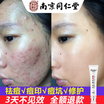 Acne light Acne Repair acne scars Li Jiaqi artifact mite removal anti-mite gel mens student ointment