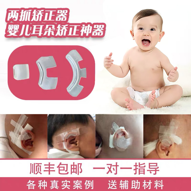 Infant auricle orthotics Baby ear corrector Newborn orthopedic deformities