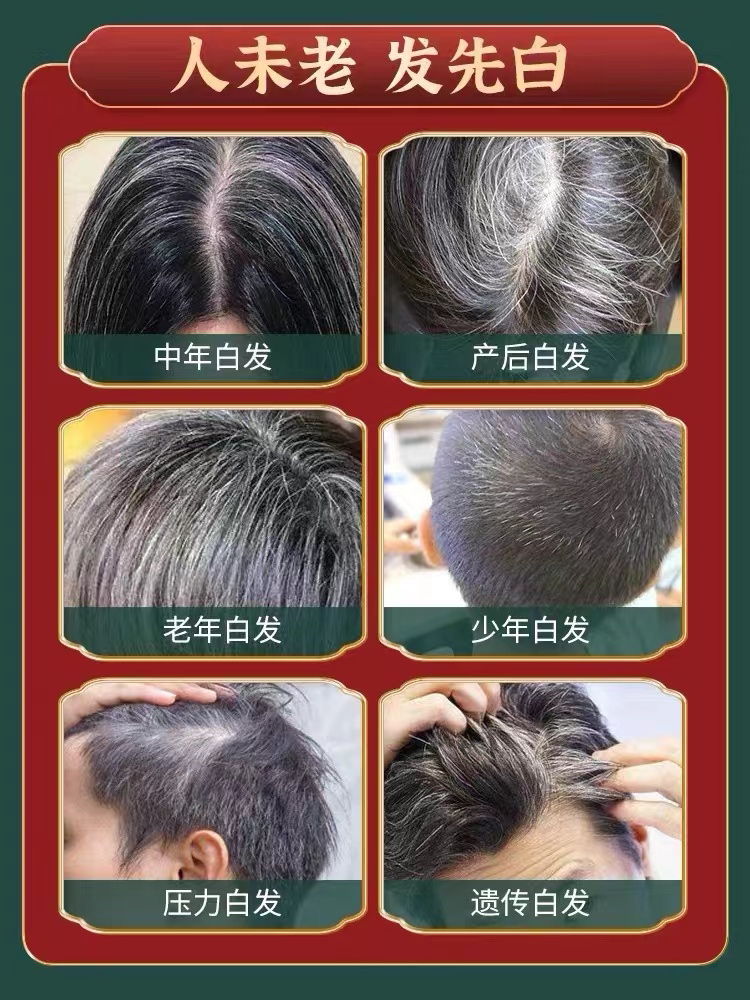 (Official) Nanjing Tongrentang white hair turns black black hair liquid black Polygonum multiflorum Ganoderma lucidum pure plant shampoo