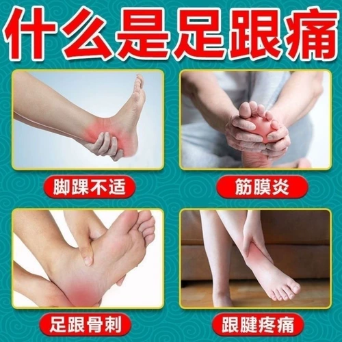 Обобальная фасция каблубная фасция гиперплазия Специальная мазь кости шпоры Удаляйте корни ахиллесо