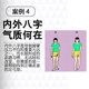 Qimaoshi 일본 평발 깔창 x 자 모양의 o 다리 발 송아지 발 외반 높은 아치 패드 지원 어린이 장치