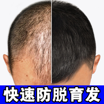 Renhe ginger shampoo hair loss serious male special anti-off rapid hair growth hair dense development hair artifact