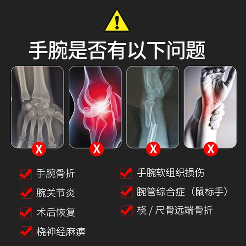 Velpeau wei li Здоровье кроволопочка перелома Finte Spot Spot вывихнул, синдром синдрома Cardo Cardo Tunoma скважины и суставы