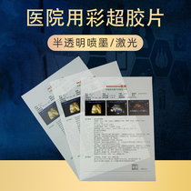  Medical film Laser B-ultrasound four-dimensional color ultrasound printing paper Gastrointestinal mirror translucent inkjet dry film paper