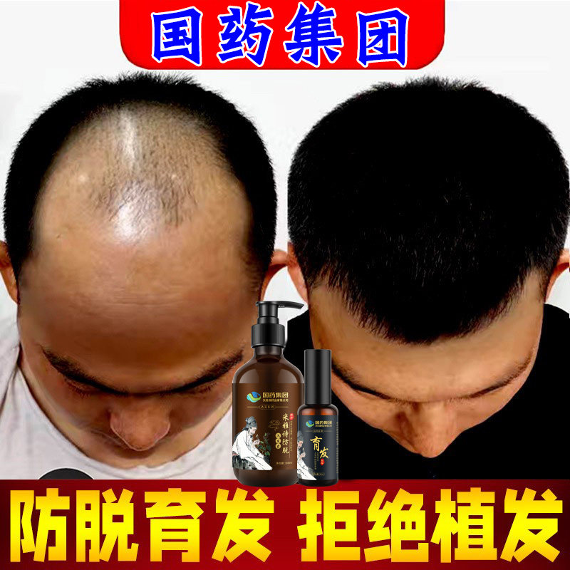 Fleece-flower anti-hair shampoo side Berleaf ginger hair ginger hair loss Serious lady's special control oil to remove the itch