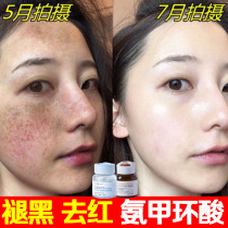  Tranexamic acid serum Aminomethyl cyclic acid Melasma freckle astaxanthin original liquid nicotinamide water VC flagship store to buy