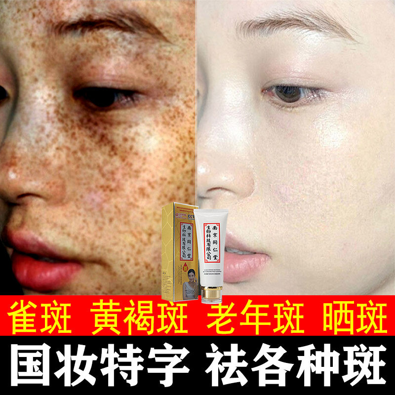Tongrentang whitening freckle removing facial cleanser female desalination melanin brightening skin color oil control moisturizing yellow cleansing