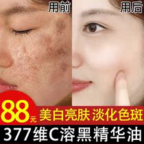Anthocyanin and Vic essence Oil facial whitening Dispatch for Cs oil flagship store Soluble Spotted Oil Essence in liquid vc