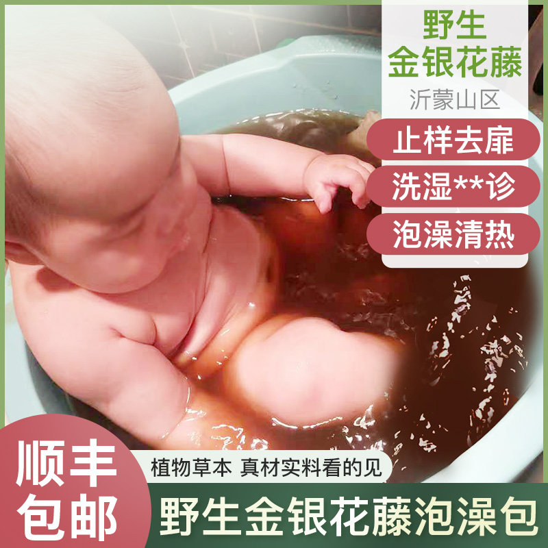Honeysuckle bath baby honeysuckle vine dry leaf root medicinal bath package Yimeng Mountain baby bath honeysuckle vine
