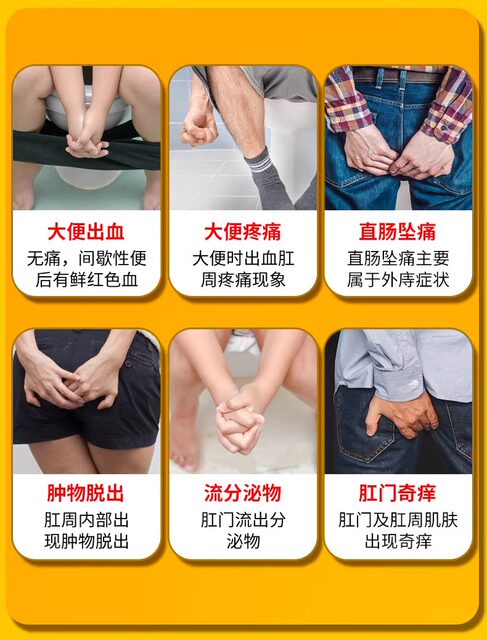 Japanese Hemorrhoid Ointment Genuine Product for Removing Hemorrhoid Lumps, Stopping Bleeding, and Healing Internal and External Hemorrhoids, Anal Fissures, and Anal Fistulas