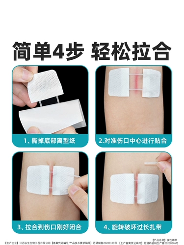 Вычитаются из шрама шва против поставщики хирургии.