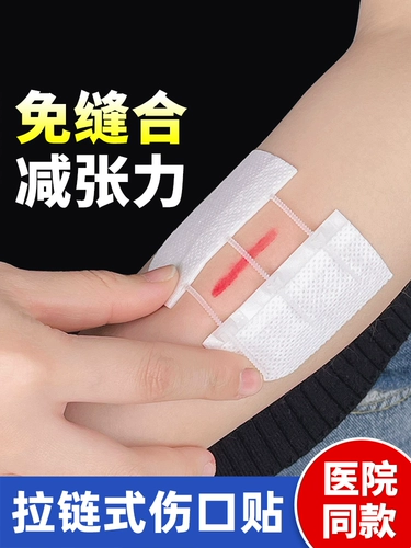 Вычитаются из шрама шва против поставщики хирургии.