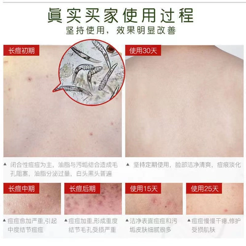 Антибактериальный универсальный гель для душа с горькой полынью подходит для мужчин и женщин, анти-акне, против зуда, глубокое очищение