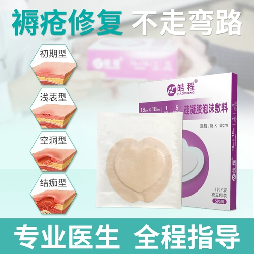 皓程 Материал -рамки вставьте давление задниц хвостовой задницы.