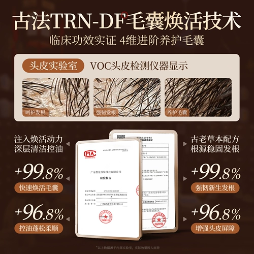 Шампунь с имбирем, контроль жирного блеска, придает объем, удаление перхоти, против зуда