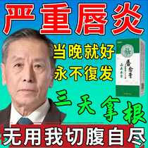 Special medicine for cheilitis to repair chapped and peeling lips. Lip balm to repair rotten corners of the mouth dry peeling and cracked lip balm.