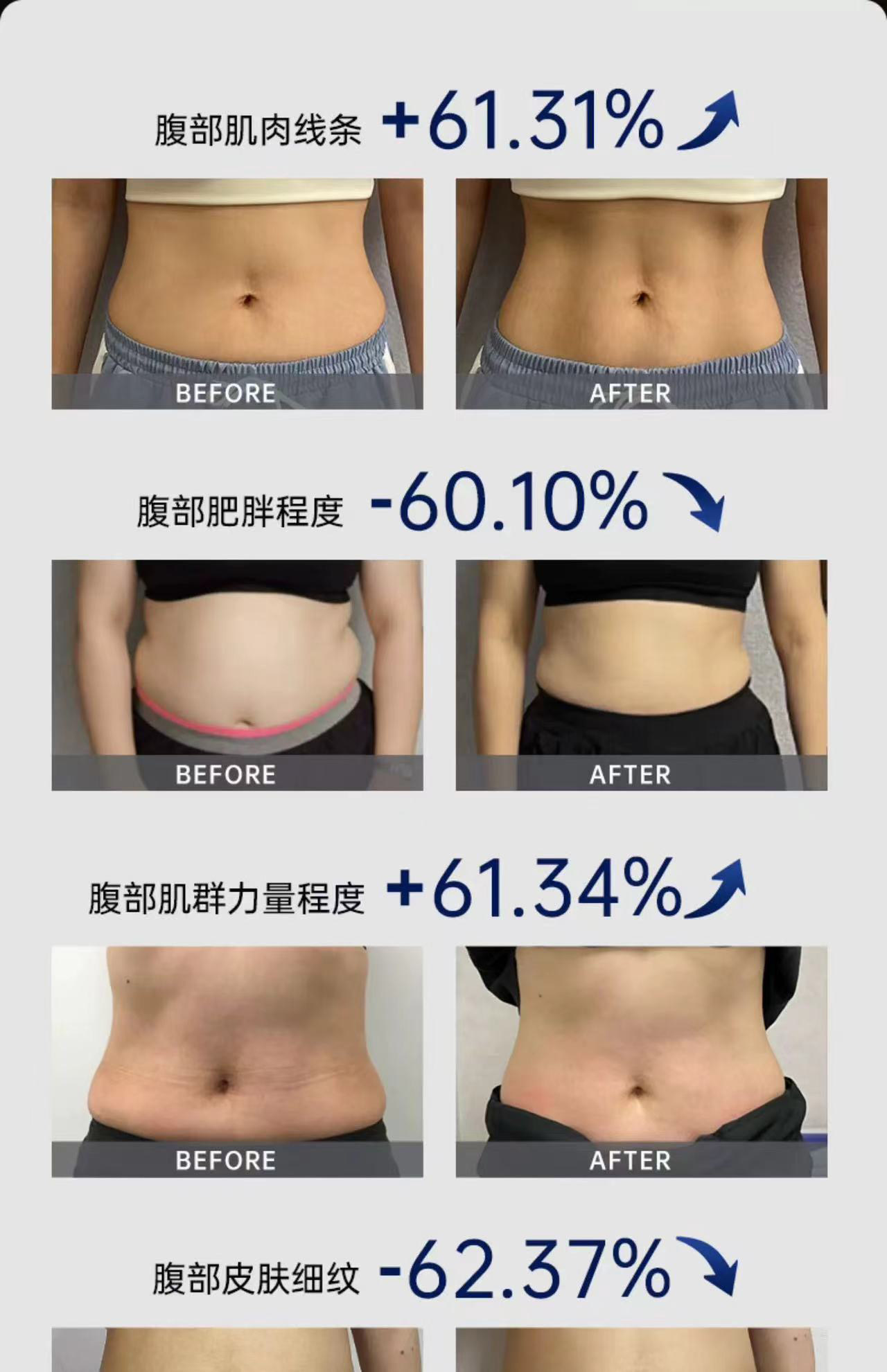 ems微电流穿戴健身仪 ems塑身腹部腰带微电流红光智能脉冲燃脂健身仪瘦身肚子减肥神器 Other