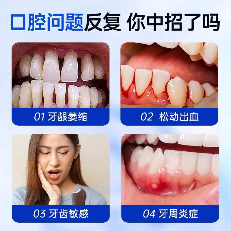2026年牙齿松动固齿专用神器怎么选？牙周炎牙龈萎缩人群为何更关注医疗器械备案与颜色分类？