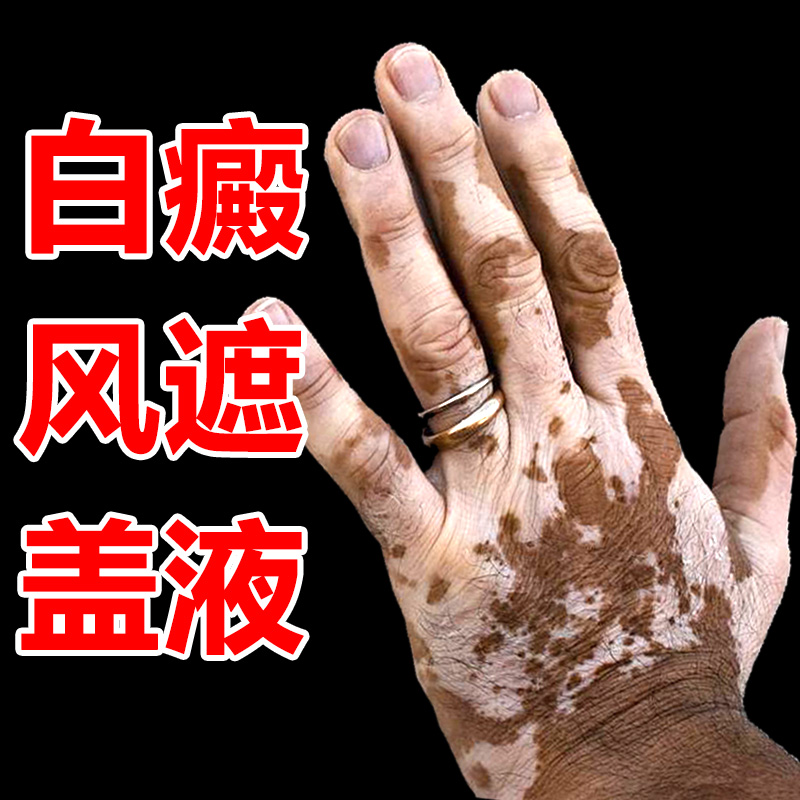 Vitiligo masking liquid artifact external use face and hand white spot skin tone mask long-lasting waterproof concealer pen