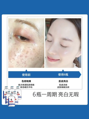 修正 Осветляющая сыворотка, меланин, эссенция для лица, удаление веснушек