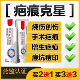 Подлинный крем для удаления рубца для удаления шрамов восстановая лицевая сторона от прыщей морской гиперплазия детская хирургия.