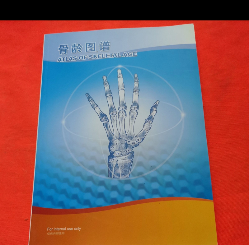 Authentic New Book in Stock, Genuine Bone Age Chart, Full-Color Interior Pages, Coated Paper, Published in 2012, Can Issue Invoice. Authentic New Book in Stock, Genuine Bone Age Chart, Full-Color Interior Pages, Coated Paper, Published in 2012, Can Issue Invoice.