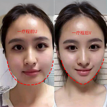  (Recommended by Weia)Small face artifact changes melon seed face in seconds big face Nemesis Buy 3 get 2 free Buy 5 get 5 free