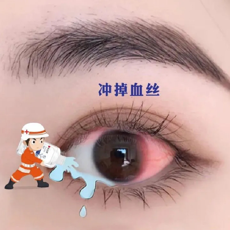 (Eye Cleansing) Camellia Eye Wash Give your eyes a bath. Dry eye care solution buy 3 get 2 free