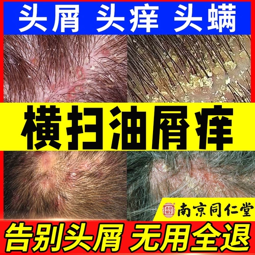 Tongrentang, шампунь для кожи головы на основе аминокислот, контроль жирного блеска, придает объем, удаление перхоти, против зуда