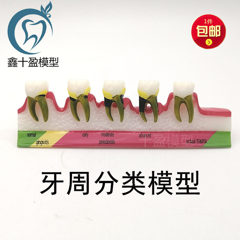 牙科材料 龋齿 演变模型 牙周分解 教学 讲解 沟通 饰品