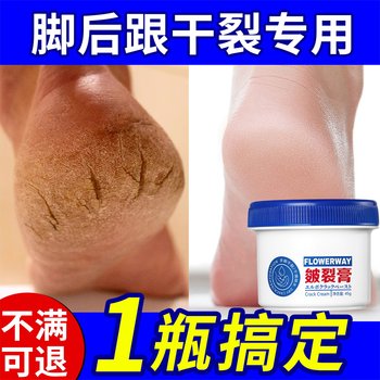 Japanese Heel Crack Repair Cream for Cracked Hands and Feet, Chapped Skin, Peeling Skin, Exfoliating Dead Skin, Moisturizing Horse Oil Wrinkle Cream