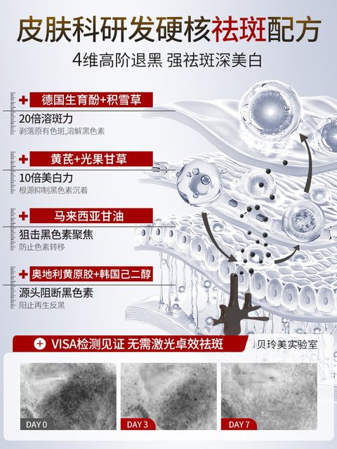 Official Flagship Store of Freckle Removal Cream, No. 1 in Authenticity, Removes Chloasma, Age Spots, Lightens Spots, Whitens and Fades Pigmentation