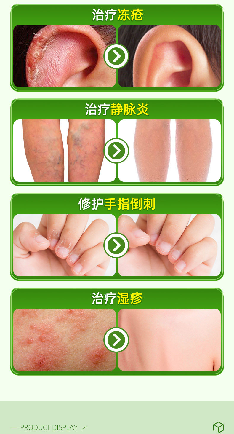 中国直邮】 硬核医生肝素钠乳膏去黑眼圈角化型湿疹手部医用软膏非5000