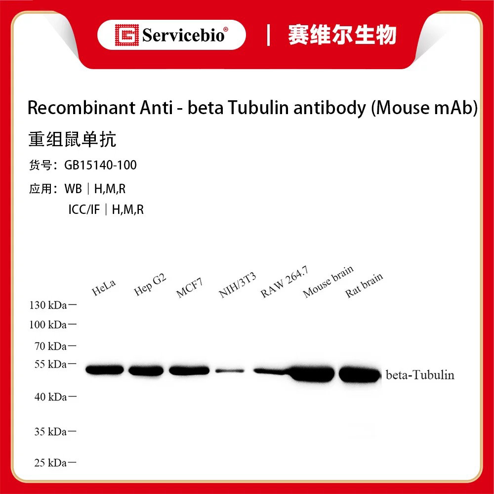 赛维尔 &beta;-Actin GAPDH &beta;-Tubulin 内参抗体 兔单抗 鼠单抗