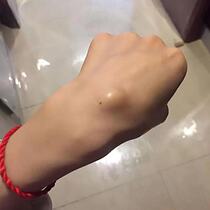 Tendon Sheath Inflammation Special Patch Cream Thumbs Finger Pain Drugpack Mouse Hand Tendon Sheath Cyst With Gluten Joint Pain