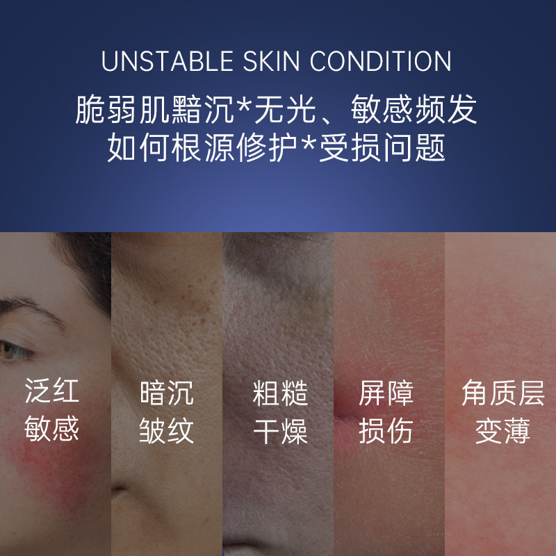 【香港直郵】 法國 佩爾赫喬 PierAuge 融雪面膜 5ml✖️5 急救修護敏感肌 雪藻萃取物 即刻褪紅 強韌屏障 塗抹式舒緩面膜