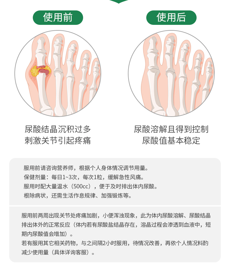 FPA澳药健康尿酸降胶囊 尿酸高痛西芹籽