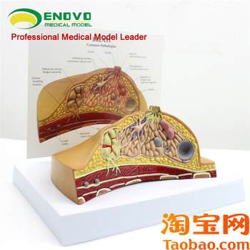 Original applicable yinuo genuine breast pathological anatomy model breast model obstetrics and gynecology teaching nursing breast model