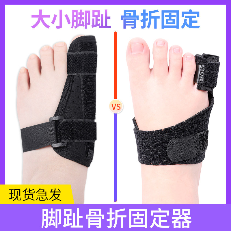 大小二脚趾骨折固定器脚大拇指趾骨弯曲受伤固定支护具夹板保护套