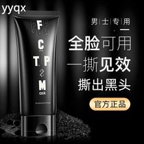 r Mens special peel-off mask to remove blackheads and nose patch to clean mud film pores blackheads and acne smear-type facial mask