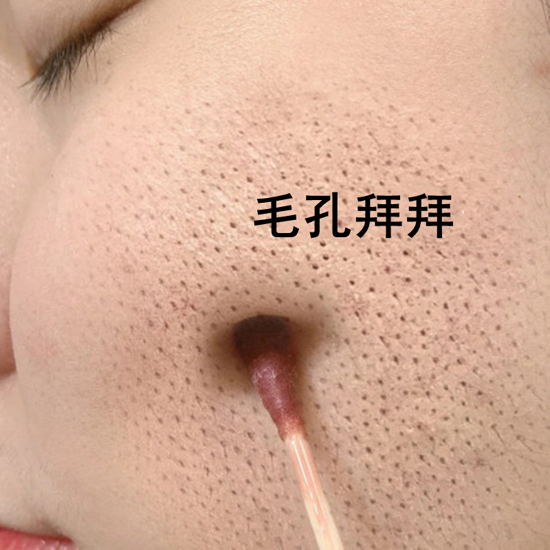 (Recommended by small red book) L-lactic acid shrinkage pore essence for men and women, general beat 2 hair 3 send the same model