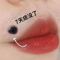 (Reject laser) Does not hurt the skin. Removes dark spots and spots on the face. Say goodbye to dirty things on the face. Suitable for impatient people.