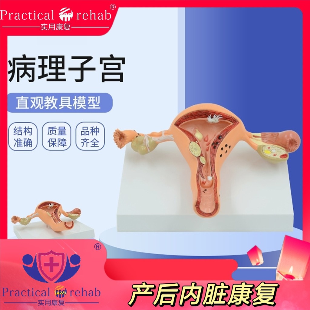 人体模型女性生殖子宫阴道卵巢子宫教学模具病理变化科普培训教具