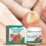 Грибные грибки Attments Serum Cream против грибковых ног ногте